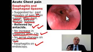 Acute Chest Pain #cme #internal_medicine #doctor  #medical #محاضرات_باطنة