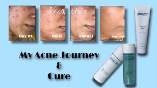 My Acne Journey \u0026 Cure with Rodan \u0026 Fields Proactiv Solution/ Skin care Routine