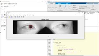 Simple Sleep Detection using MATLAB