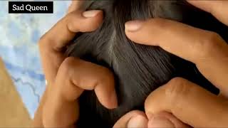 ASMR nits picking \u0026 lice removal from long hair part 01