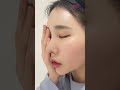 코수술 하나로 존예 귀요미 변신 mightyplasticsurgery 자가늑코수술