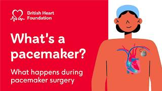 What is a pacemaker and how does it work?