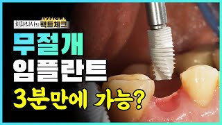 무절개 임플란트 3분만에 가능하다고❓ (수술시간 과정 공개)