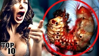 Top 10 Shocking Things Found Growing Inside Of People