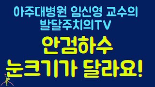 86. 안검하수 : 눈크기가 달라요! 눈꺼풀이 처져있어요!