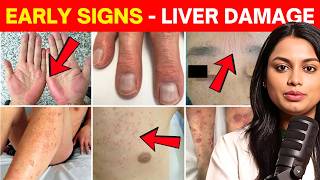 Doctor Explains 7 Signs Your Liver is Asking for Help (With Solution)