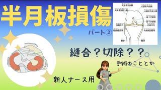 【半月板損傷②】半月板縫合術＆切除術を簡潔に学ぶ★#整形外科#看護師#勉強