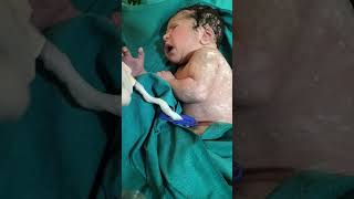 New born baby just after birth umbilical cord cutting with me #birthmoment #cutebaby #babyshorts