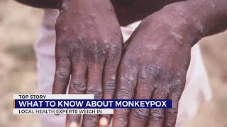 Monkeypox: how worried should we be?