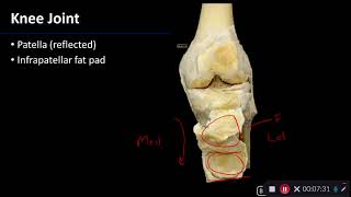 Knee Joint - Dissection Supplement