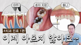 ※치과 방문 전 필수 시청※ 요즘 치과 과잉 진료 없는 진짜 이유? 발전한 치과 진료 방식을 알려드립니다!!