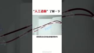 Ecmo 人工肺的了解