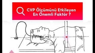 CVP ölçümü: Santral venöz basıncı etkileyen en önemli faktör #yoğunbakım #hemşire #sağlıkçı #keşfet