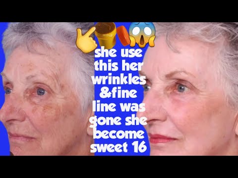 How To Get Rid Of Wrinkles Fine Line With Just Simple Remedies.use This ...