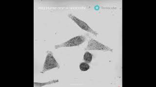 Mitosis and human cervical cancer cells (HeLa)