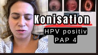 Konisation Unzensiert: Mein ehrlicher Bericht über den Eingriff | Vlog | HPV positiv PAP 4