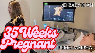 35 Weeks Pregnancy Update Vlog | 4D Baby Scan, Weekly Bump Update, Preeclampsia, Third Trimester