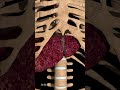 Can You Survive with Liver Cirrhosis