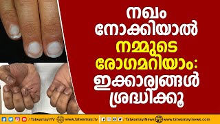 നഖം നോക്കിയാല്‍ നമ്മുടെ രോഗമറിയാം: ഇക്കാര്യങ്ങൾ ശ്രദ്ധിക്കൂ | NAIL