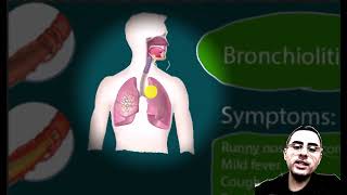 Lower Respiratory Infections: Bronchitis, Pneumonia, Bronchiolitis.