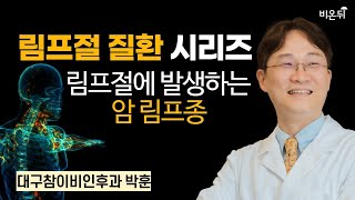 림프절 질환 시리즈: 림프절에 발생하는 암 림프종 / 대구참이비인후과 박훈