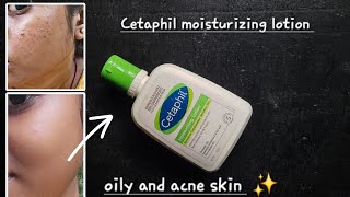 'Cetaphil moisturizing lotion' Is this for acne and oily skin ? | Watch this video to find out 🧿✨️