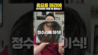 음모( xx털 )을 머리에 심으면 어떻게 되나요?