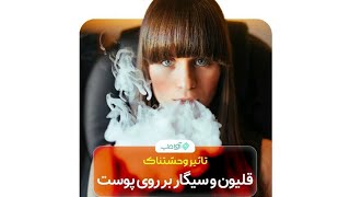 تاثیر وحشتناک قلیون و سیگار بر روی پوست