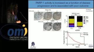 PARP and DNA repair defects (BRCA mutations) - Karen E. Knudsen