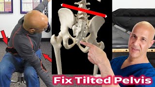 Fix Uneven Pelvis & Hips in 60 Seconds | Dr. Mandell