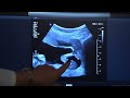 your first ob ultrasound oakdale obgyn