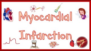 Myocardial Infarction[Heart Attack]; Causes, Pathogenesis, Signs & Symptoms, Diagnosis & Treatment