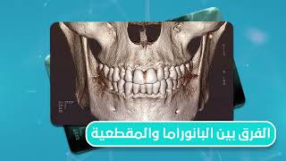 DentaScan : Panorama Vs CBCT .. الفرق بين أشعة البانوراما و الأشعة المقطعية للأسنان