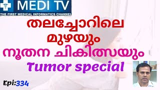 Ep 354_Tumor Special | തലച്ചോറിലെ മുഴ | Dr.Manoj Krishnan | MEDITV | 2020