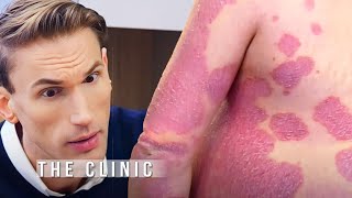 Doctors Shock at Rare Skin Disease! 😲