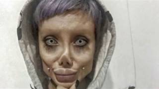 سحر تبرIranian 19 years old girl undergoes 50 Surgeries to look like Angelina Jolie but went too far