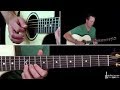 Whatever It Takes Guitar Lesson - Imagine Dragons