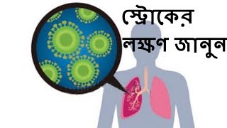 চার অক্ষরে স্ট্রোকের লক্ষণ জানুন l Learn the signs of stroke in four letters