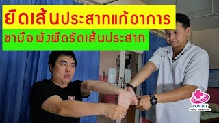 ยืดเส้นประสาทลดอาการชามือชานิ้ว พังผืดรัดเส้นประสาท Carpal tunnel syndrome (CTS )