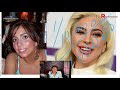 lady gaga plastic surgery how to create beauty