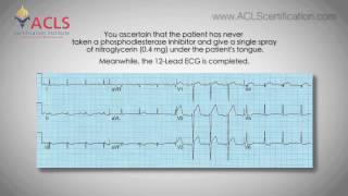 ACLS Megacode Series Video 5 by ACLS Certification Institute