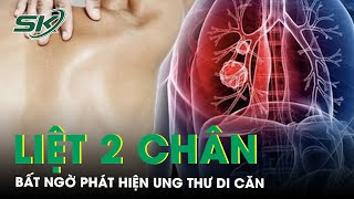 Liệt 2 Chân Mới Bất Ngờ Phát Hiện Mắc Ung Thư Di Căn | SKĐS