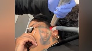 "That Hurts" Chrisean Rock Breaks Out In Tears While Getting Her Blueface Tattoo Removed!
