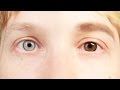 People Change Their Eye Color For A Week