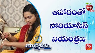 ఆహారంతో సోరియాసిస్ | ఆరోగ్యమస్తు | 22nd డిసెంబర్ 2022 | ఈటీవీ  లైఫ్