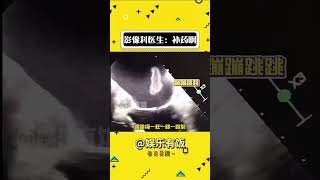 医生：不要啊 #娱乐评论大赏 #万万没想到#shorts