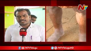 Special Focus On Side Effects Of Uranium Project In Kadapa District || NTV