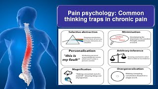 Pain psychology: Cognitive distortions in chronic pain