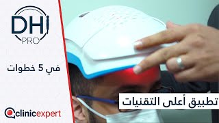 DHI PRO : أحدث تقنيات زراعة الشعر في تركيا