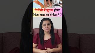 प्रेग्नेंसी में सूजन होना किस बात का संकेत है?